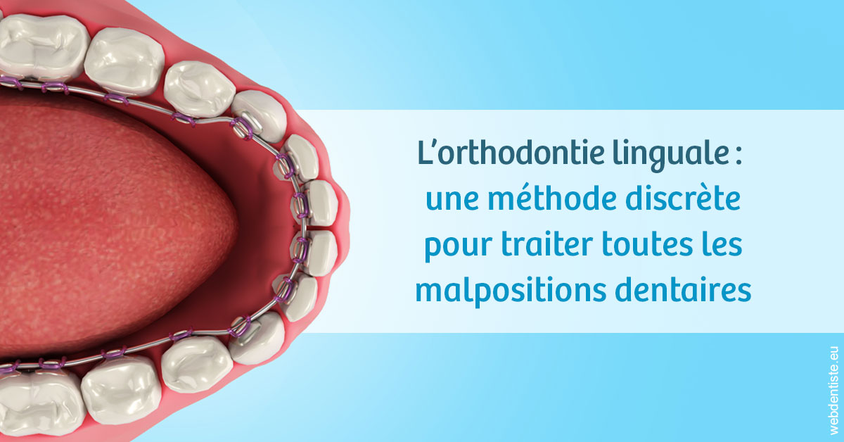 https://dr-leroy-gregory.chirurgiens-dentistes.fr/L'orthodontie linguale 1