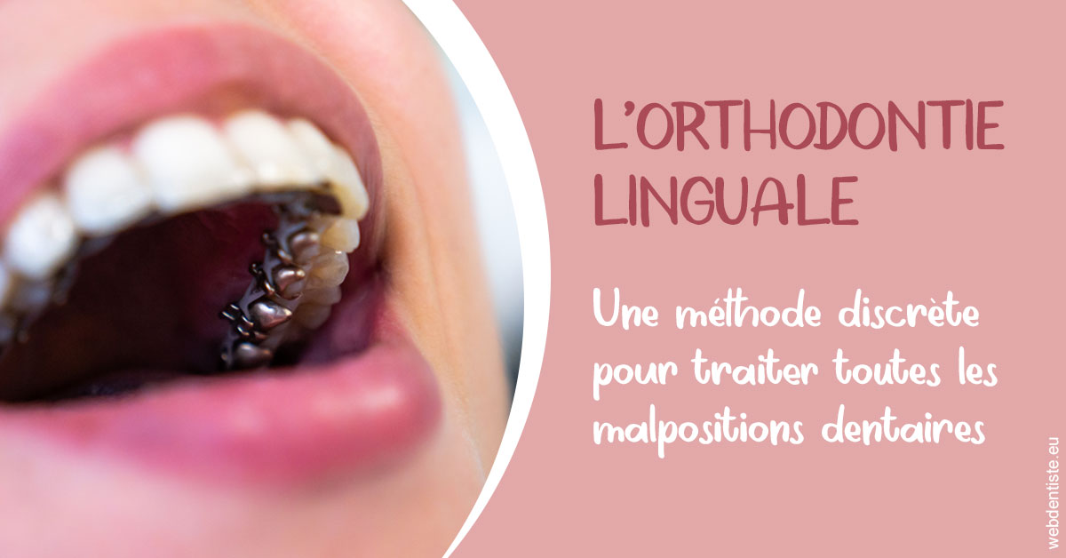 https://dr-leroy-gregory.chirurgiens-dentistes.fr/L'orthodontie linguale 2