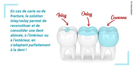 https://dr-leroy-gregory.chirurgiens-dentistes.fr/L'INLAY ou l'ONLAY