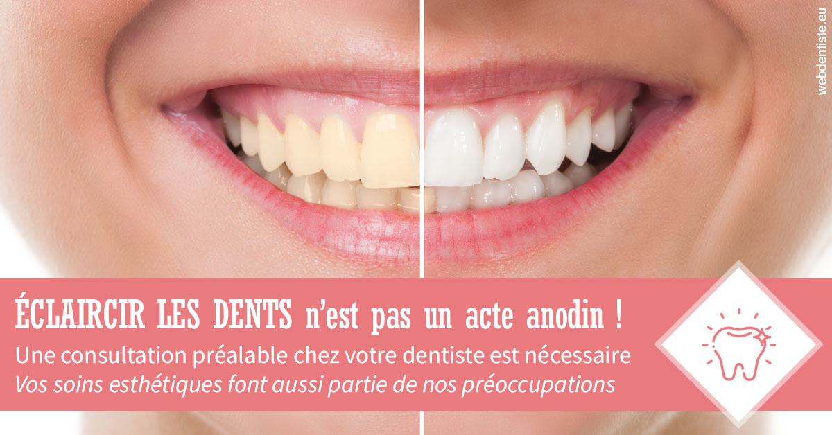 https://dr-leroy-gregory.chirurgiens-dentistes.fr/Eclaircir les dents 1