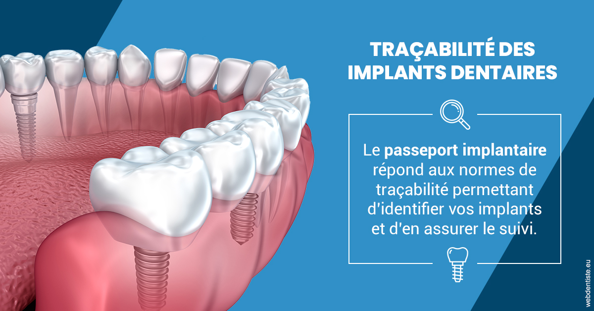 https://dr-leroy-gregory.chirurgiens-dentistes.fr/T2 2023 - Traçabilité des implants 1