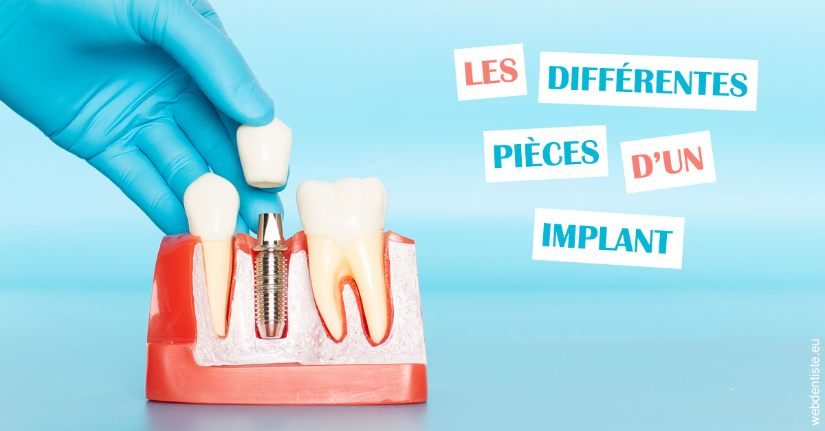 https://dr-leroy-gregory.chirurgiens-dentistes.fr/Les différentes pièces d’un implant 2