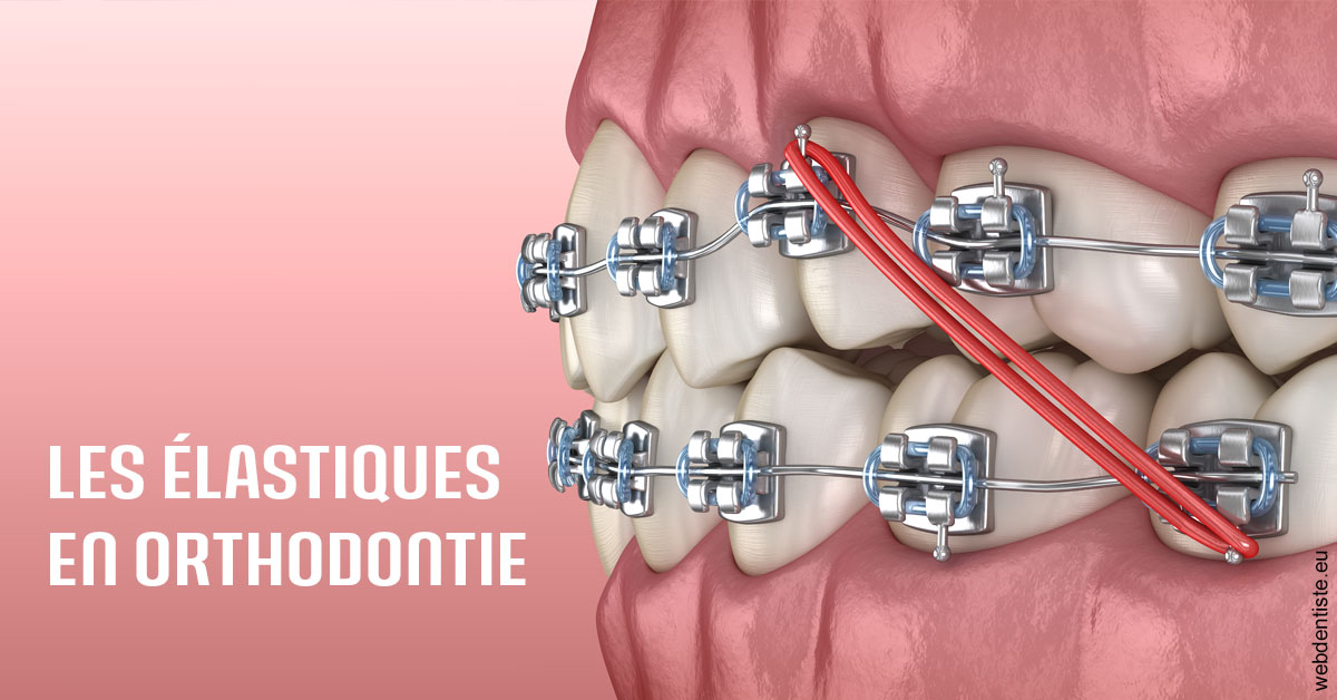 https://dr-leroy-gregory.chirurgiens-dentistes.fr/Elastiques orthodontie 2