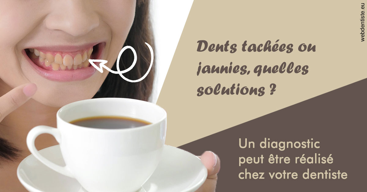 https://dr-leroy-gregory.chirurgiens-dentistes.fr/Dents tachées 1
