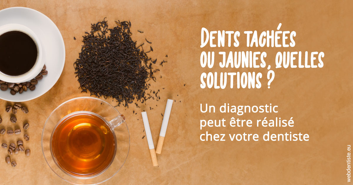 https://dr-leroy-gregory.chirurgiens-dentistes.fr/Dents tachées 2