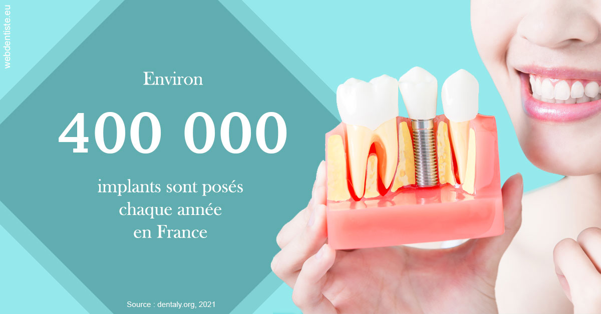 https://dr-leroy-gregory.chirurgiens-dentistes.fr/Pose d'implants en France 2